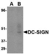 Anti-DC-SIGN Antibody