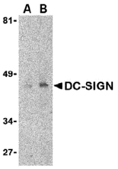 Anti-DC-SIGN Antibody