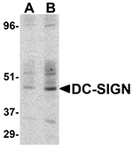 Anti-DC-SIGN Antibody