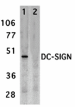 Anti-DC-SIGN Antibody