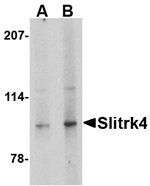 Anti-Slitrk4 Antibody