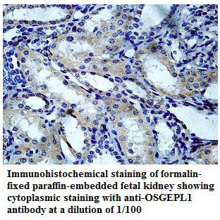 Anti-OSGEPL1 Antibody