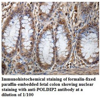 Anti-POLDIP2 Antibody