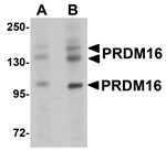 Anti-PRDM16 Antibody