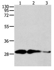 Anti-CAPNS1 Antibody