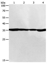 Anti-PSMD14 Antibody