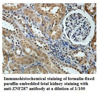 Anti-ZNF287 Antibody