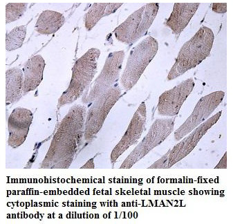 Anti-LMAN2L Antibody