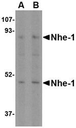 Anti-Nhe-1 Antibody