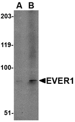 Anti-EVER1 Antibody