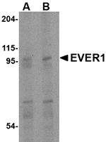 Anti-EVER1 Antibody