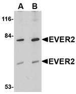 Anti-EVER2 Antibody