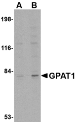 Anti-GPAT1 Antibody