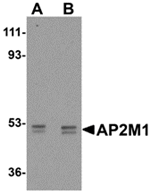 Anti-AP2M1 Antibody