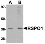 Anti-RSPO1 Antibody