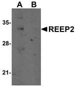 Anti-REEP2 Antibody