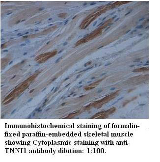 Anti-TNNI1 Antibody