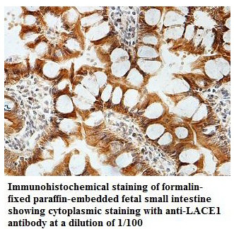 Anti-LACE1 Antibody