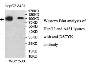 Anti-DSTYK Antibody