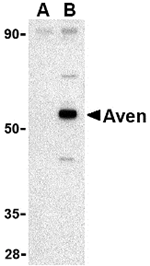 Anti-Aven Antibody