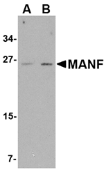 Anti-MANF Antibody