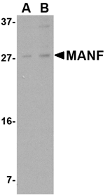 Anti-MANF Antibody