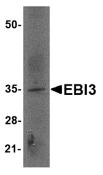 Anti-EBI3 Antibody