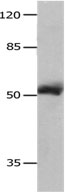 Anti-MMP8 Antibody