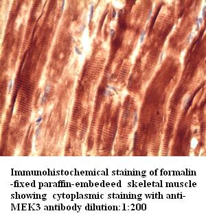 Anti-MEK3 Antibody