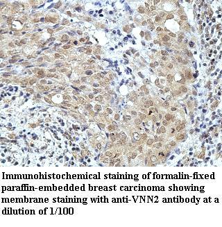 Anti-VNN2 Antibody