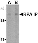 Anti-RPA Interacting Protein Antibody