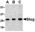 Anti-Slug Antibody