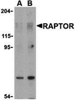 Anti-Raptor Antibody