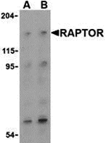 Anti-Raptor Antibody