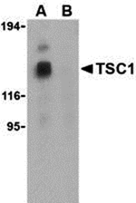 Anti-TSC1 Antibody