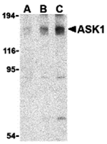 Anti-ASK1 Antibody