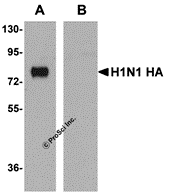 Anti-Seasonal H1N1 Hemagglutinin Antibody