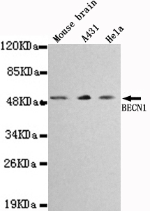 Anti-BECN1 Antibody