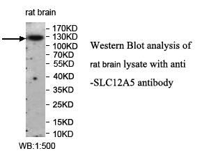 Anti-SLC12A5 Antibody