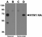 Anti-Seasonal H1N1 Hemagglutinin Antibody