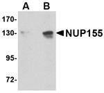 Anti-NUP155 Antibody