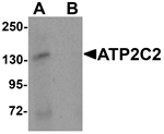 Anti-ATP2C2 Antibody