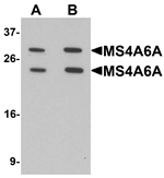 Anti-MS4A6A Antibody