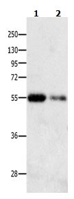 Anti-CAMK1G Antibody