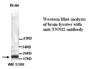 Anti-TNNI2 Antibody