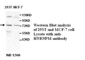 Anti-HNRNPM Antibody