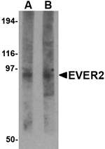 Anti-EVER2 Antibody