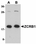 Anti-ZCRB1 Antibody
