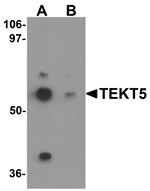 Anti-TEKT5 Antibody