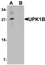 Anti-UPK1B Antibody